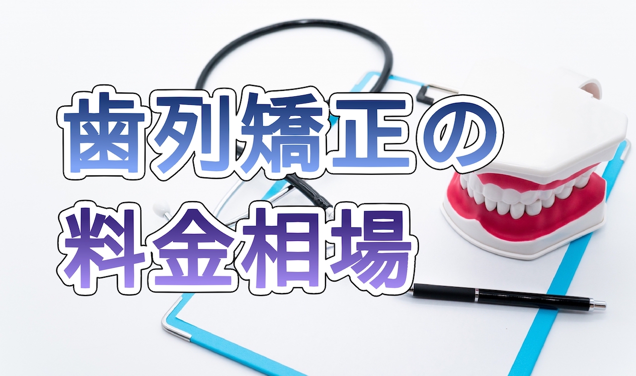 歯列矯正の料金相場