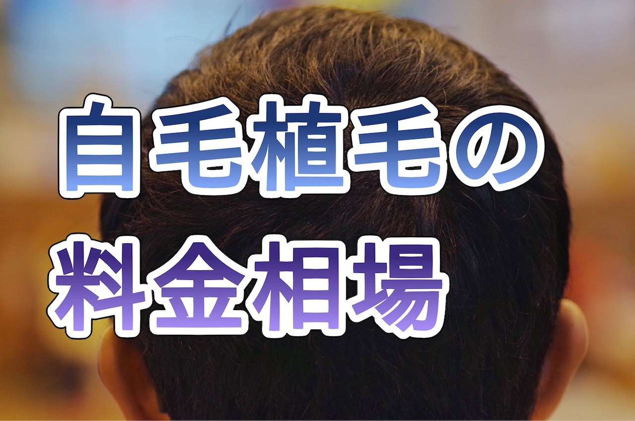 自毛植毛の料金相場