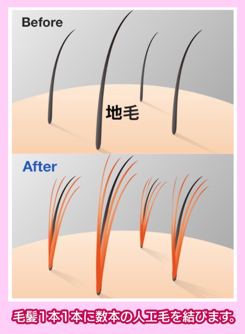 増毛ビフォーアフター