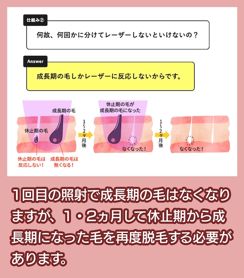 何回かに分けてレーザー照射をしないといけない理由