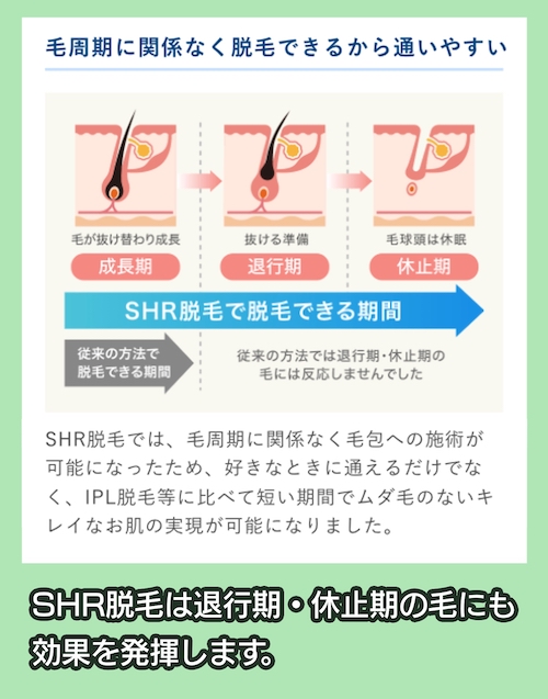 SHR脱毛とは