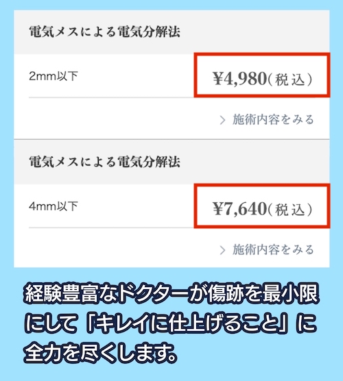 TCB東京中央美容外科の料金相場