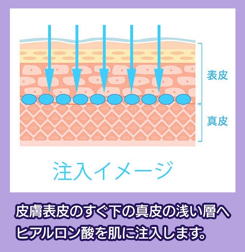 美肌効果の仕組み