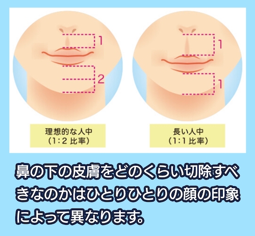 人中短縮