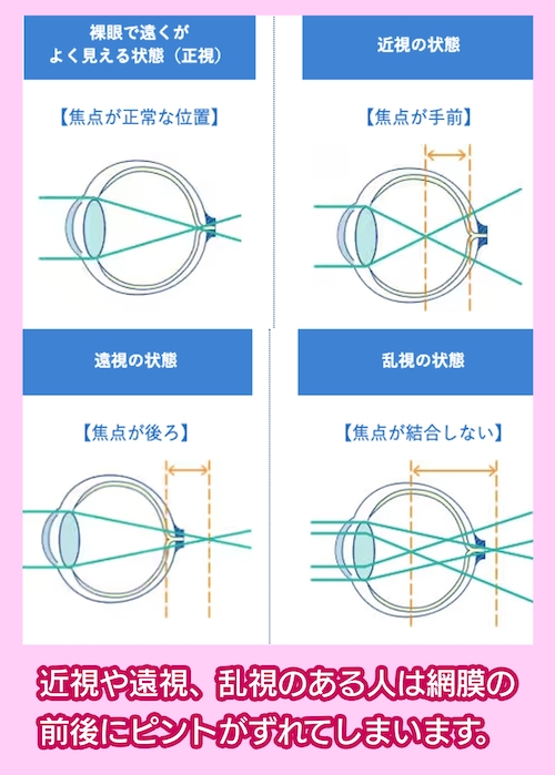 目の焦点の状態と見え方