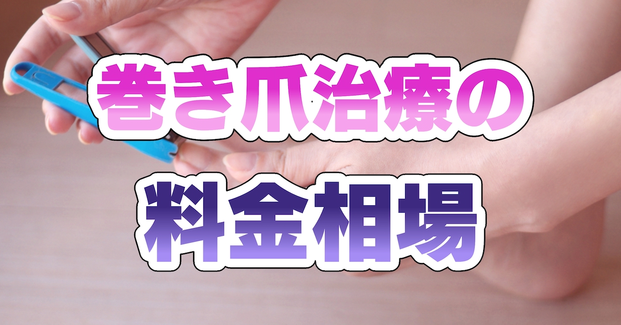 巻き爪治療の料金相場