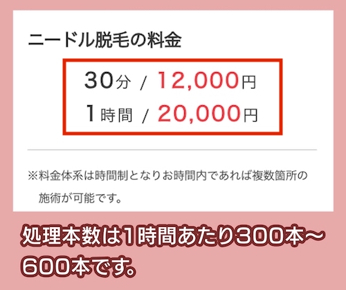 メンズ脱毛サロンAlonsoの料金相場