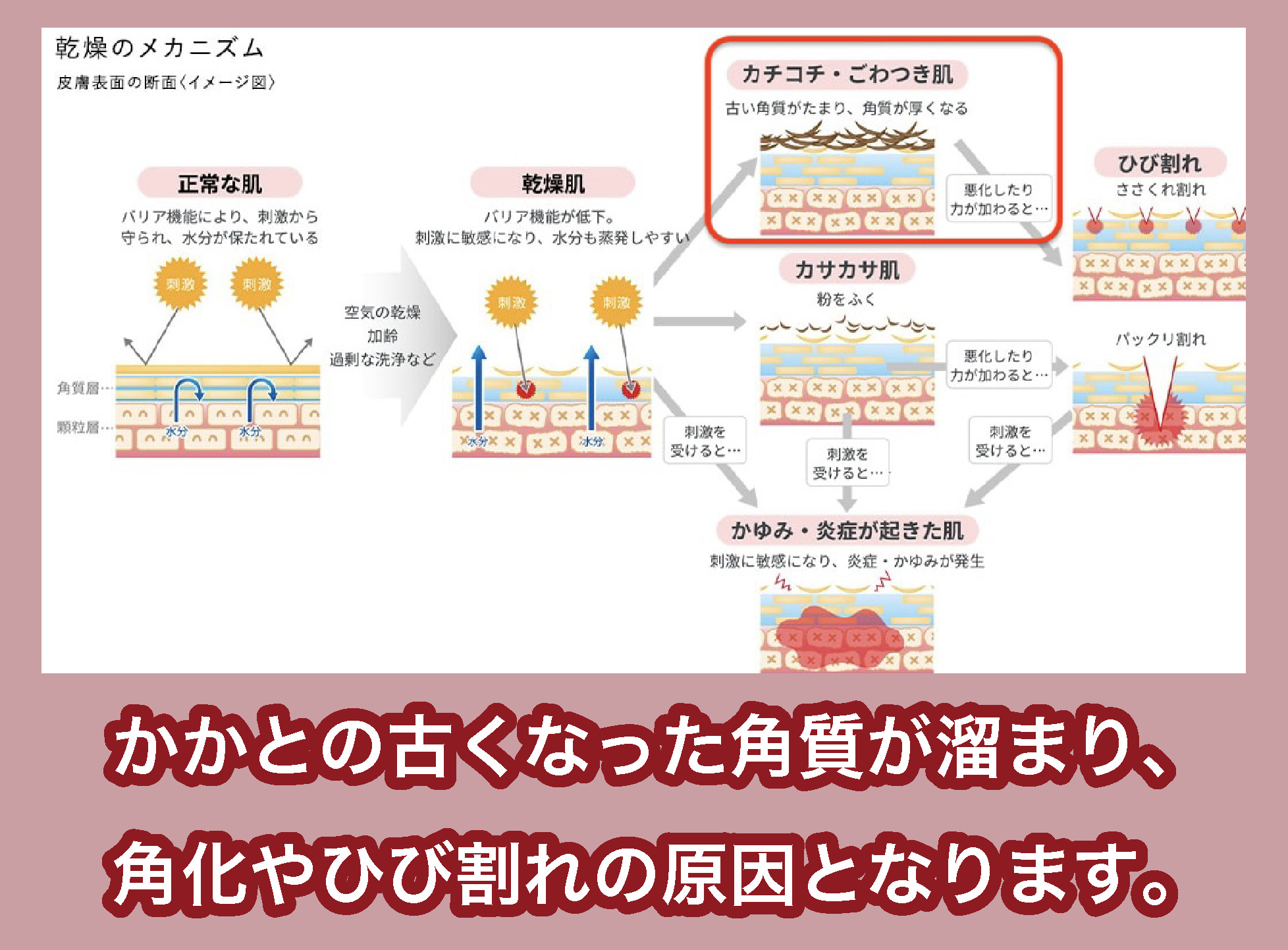 肌が乾燥するメカニズム