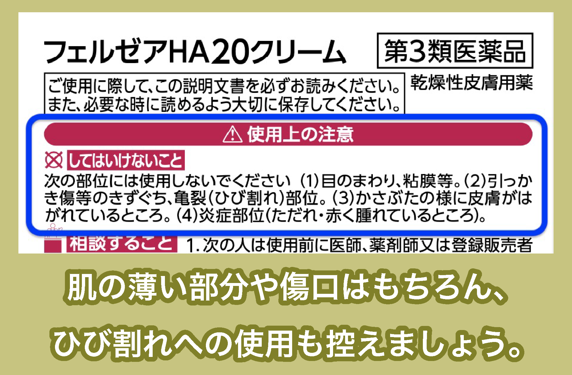 かかとケア用の尿素配合クリームの注意点