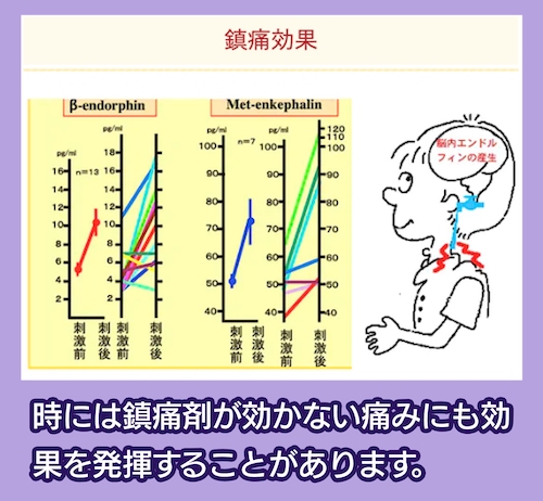 鍼灸院みらい京都桂 鎮痛効果