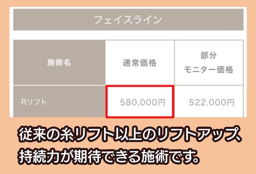 リゾナスフェイスクリニック東京の糸リフトの料金