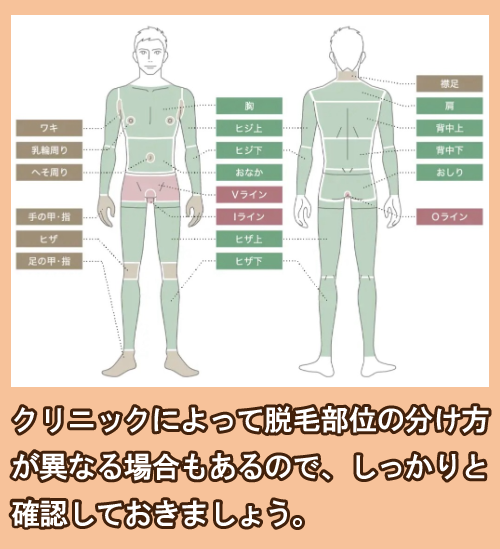 脱毛部位の名称