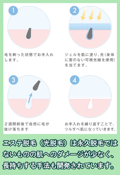 エステ脱毛の仕組み