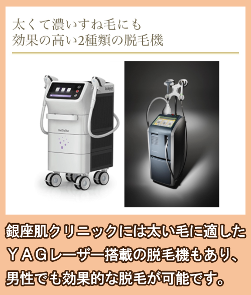 医療脱毛機の方式