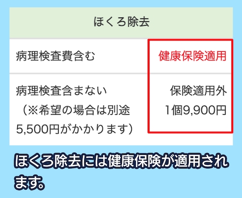 ソノクリニックの料金相場