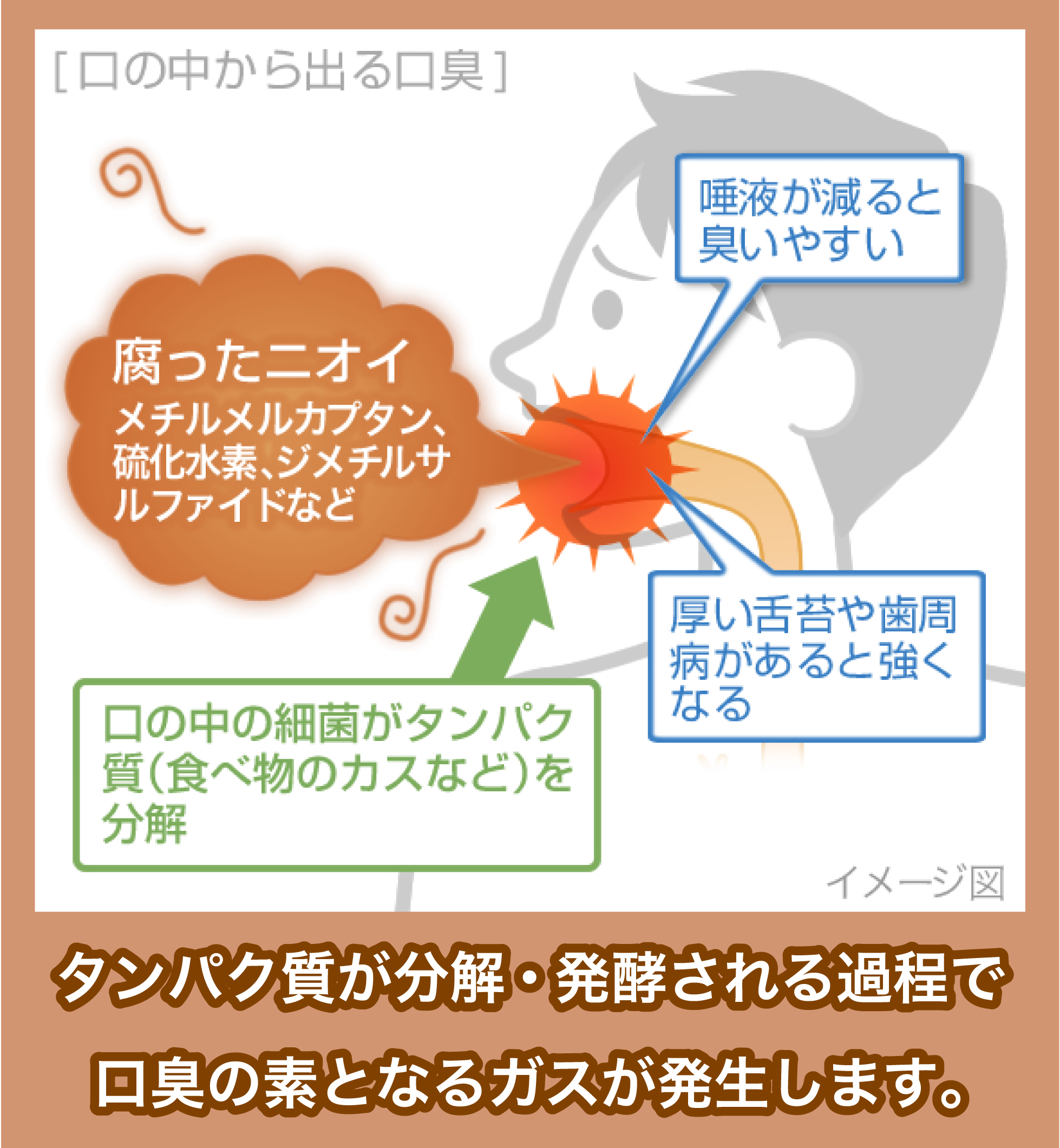口臭の原因