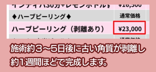 シュリーSriiiの料金相場